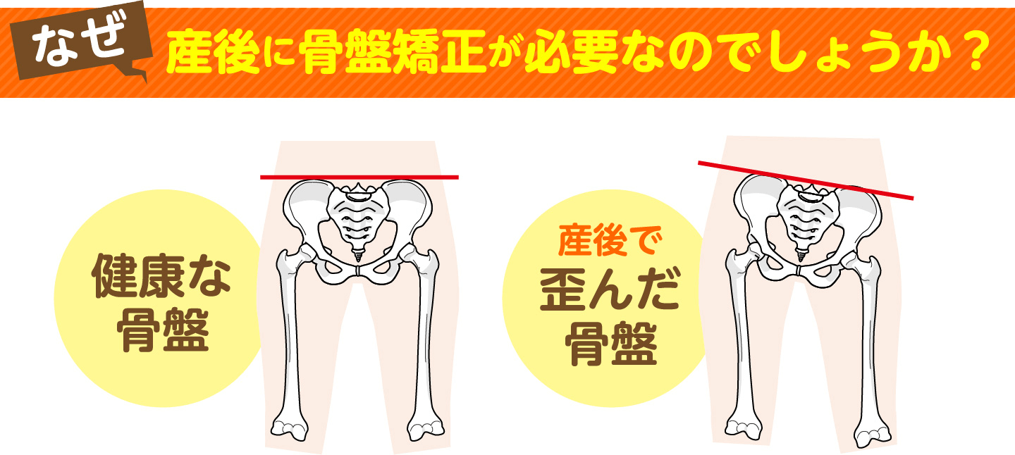 なぜ産後に骨盤矯正が必要なのでしょうか？